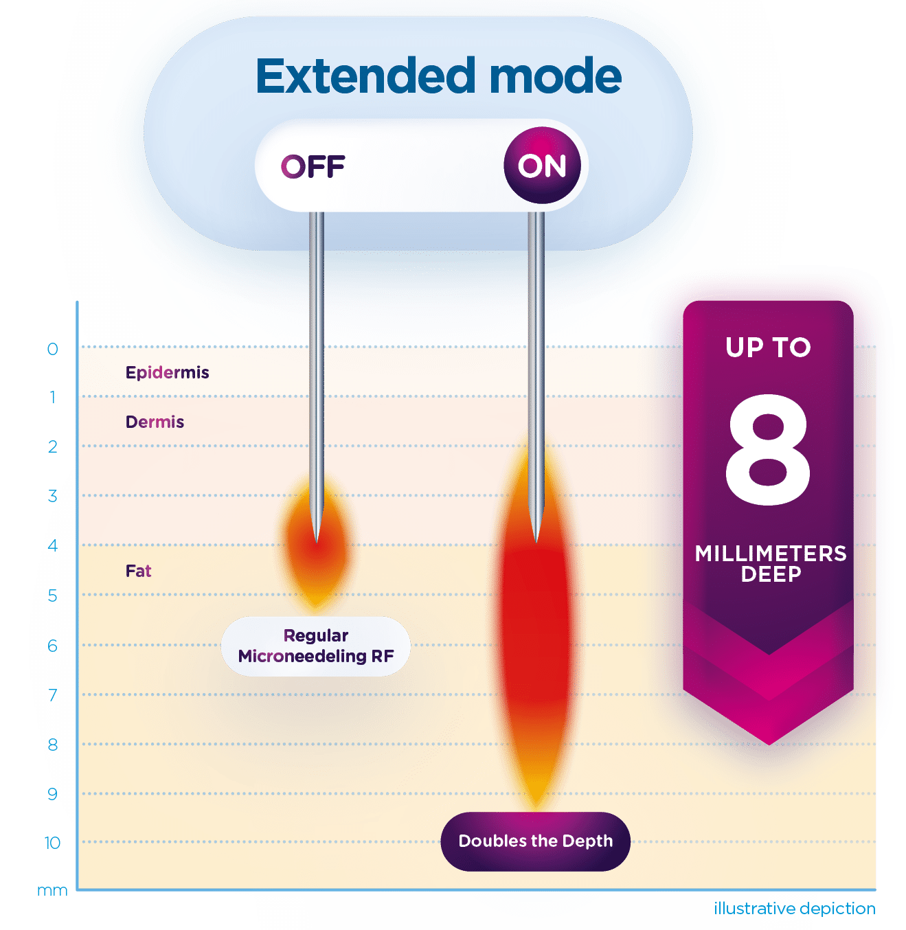 Exion_PIC_MOA_Fractional-RF_ENUS100